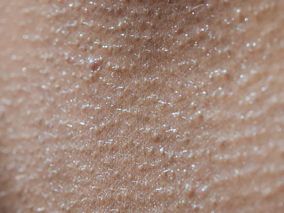 Macro van huid met fijne bobbeltjes, als kippenvel
